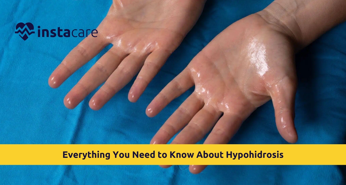 Picture of Everything You Need to Know About Hypohidrosis