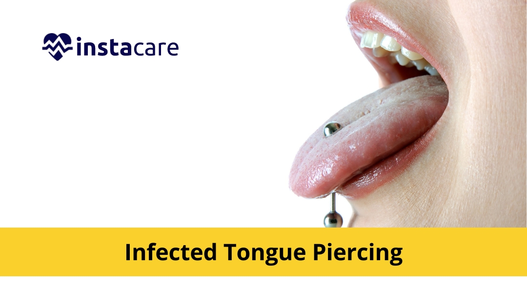 Infected Ear Piercing: Symptoms, Treatment & Prevention