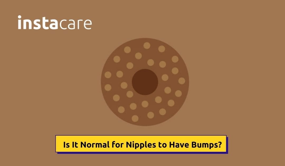 Is It Normal For Nipples To Have Bumps InstaCare