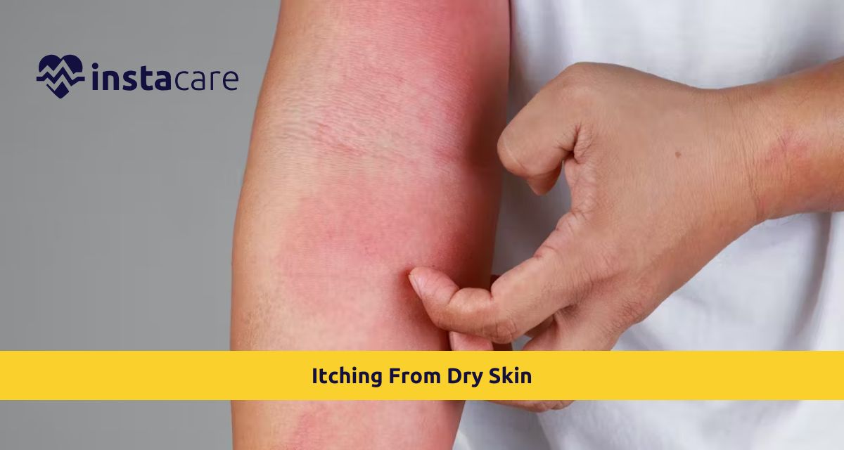 Picture of Itching From Dry Skin Prevention and Treatment