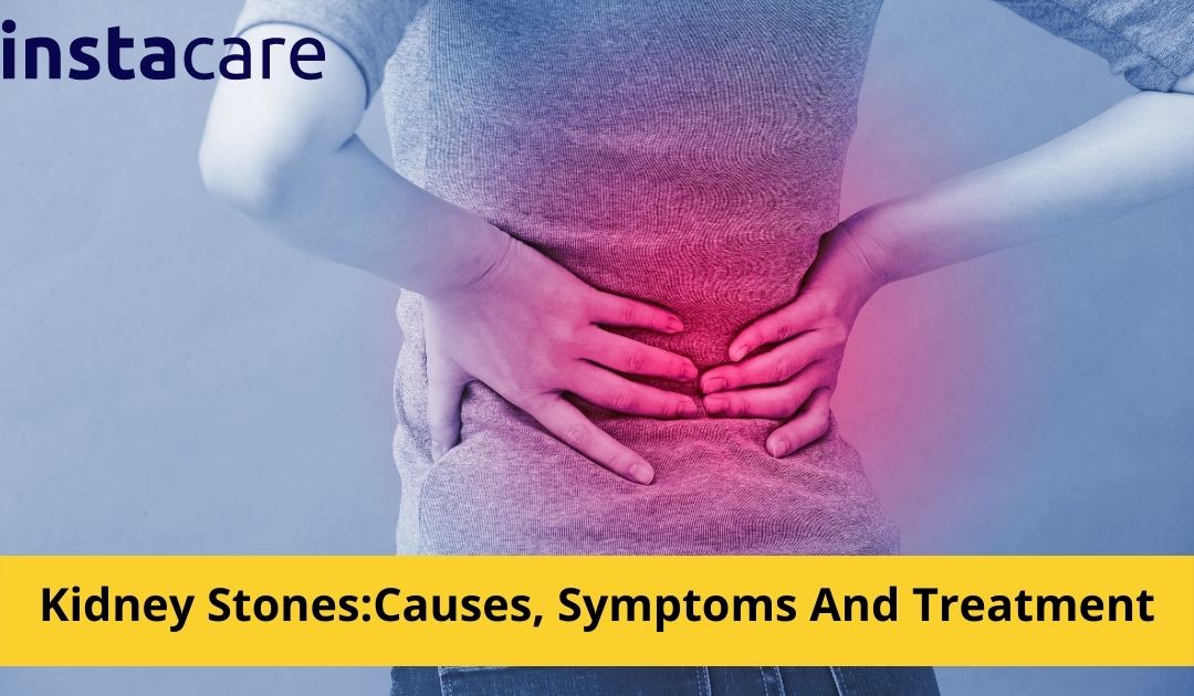 Picture of Kidney Stones Causes Symptoms And Treatment