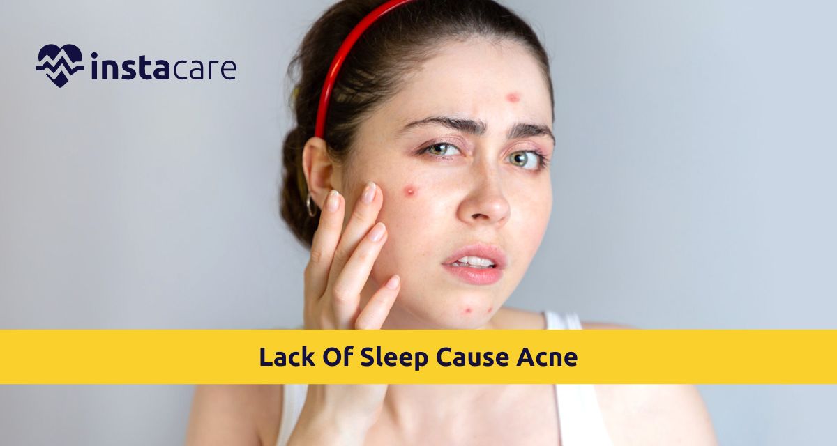 Picture of Does Lack Of Sleep Cause Acne