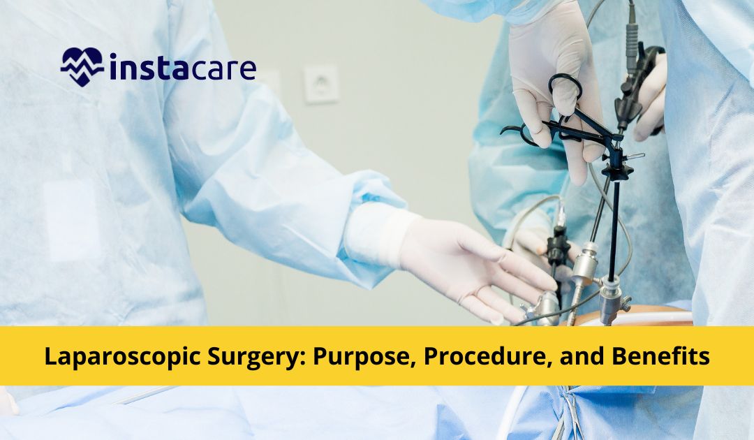 A Beginner's Guide To Laparoscopic Surgery - What You Need To Know