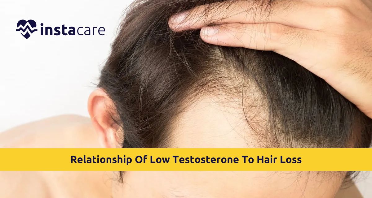 Picture of Does Low Testosterone Lead to Hair Loss