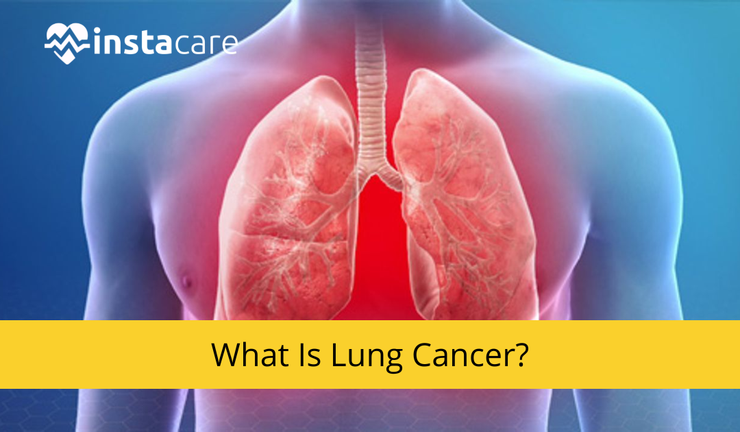 Picture of What is Lungs Cancer Types Symptoms Causes Threats Treatment