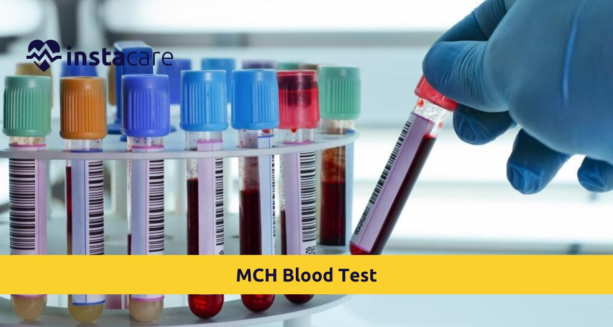 Picture of All You Must Know About MCH Blood Test