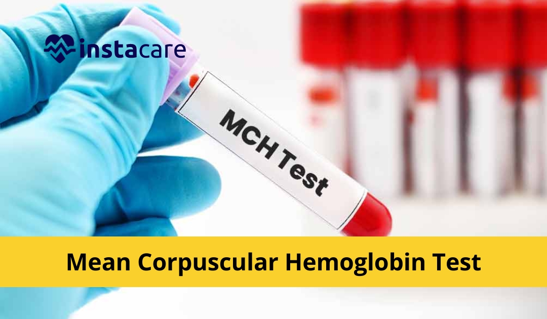 Picture of What You Must Know About Mean Corpuscular Hemoglobin Test