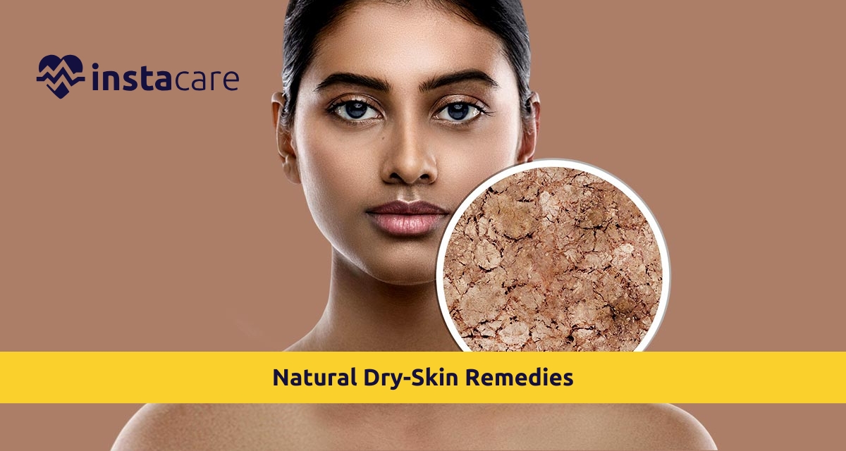 Picture of 10 Natural Dry-Skin Remedies You Can Do At Home