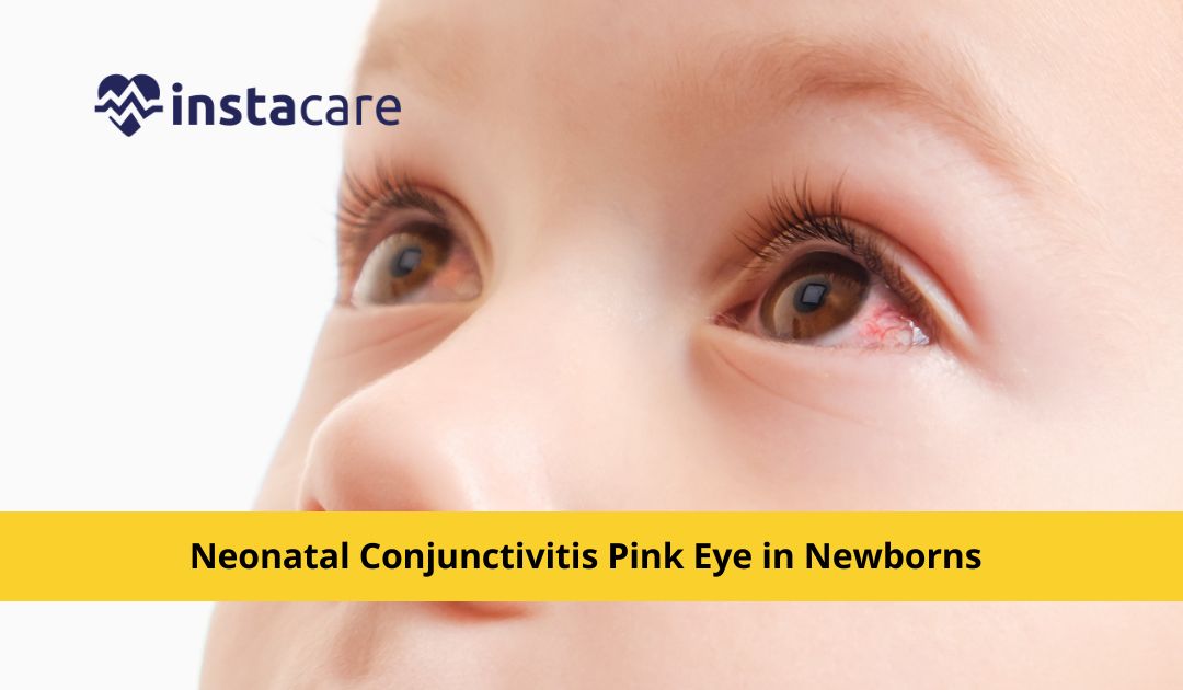 Pinkeye (conjunctivitis) in babies