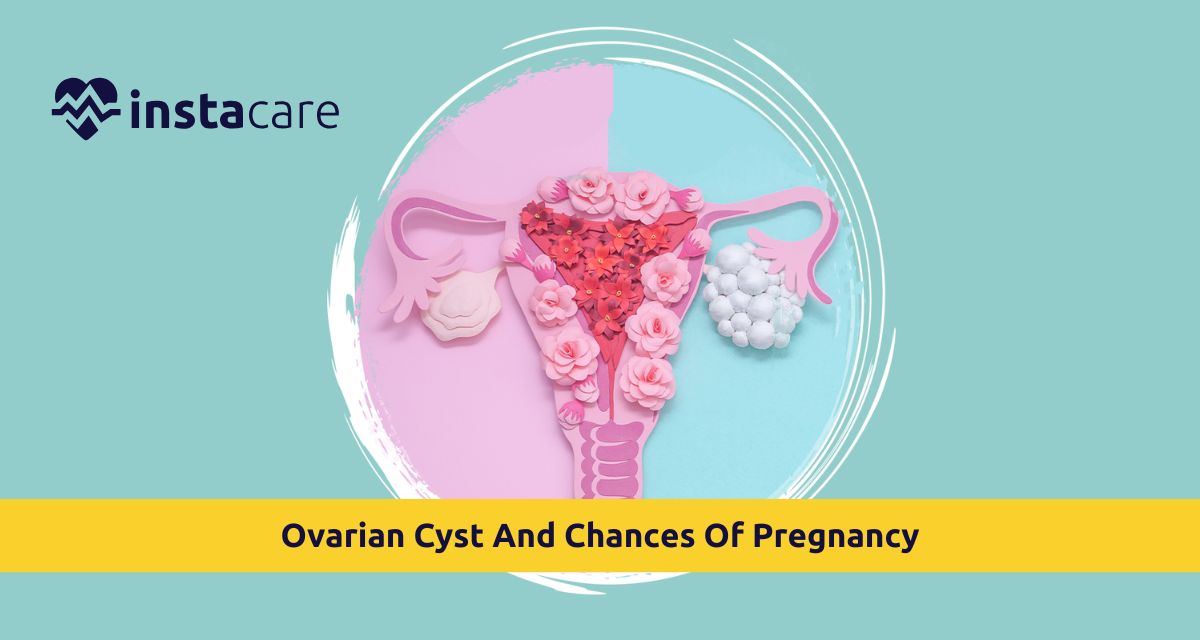 Picture of All You Need To Know About Ovarian Cyst And Chances Of Pregnancy