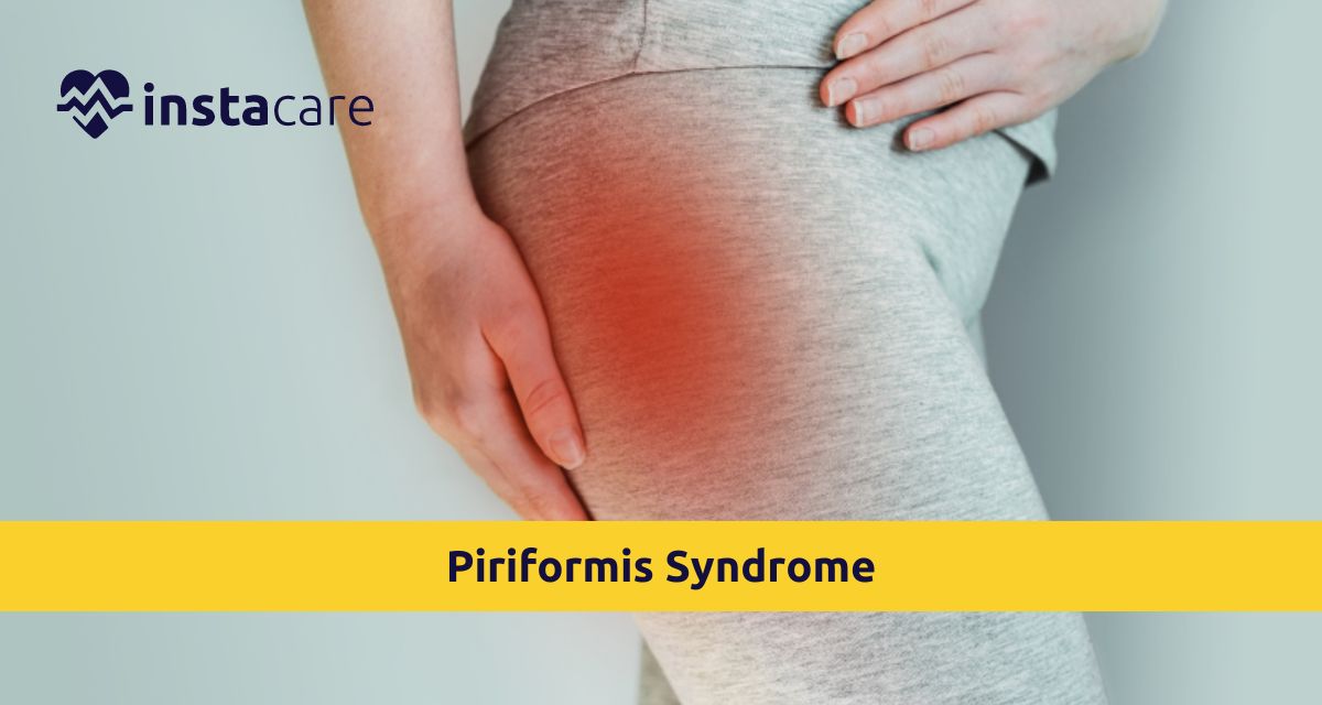 Picture of What You Must Know About Piriformis Syndrome