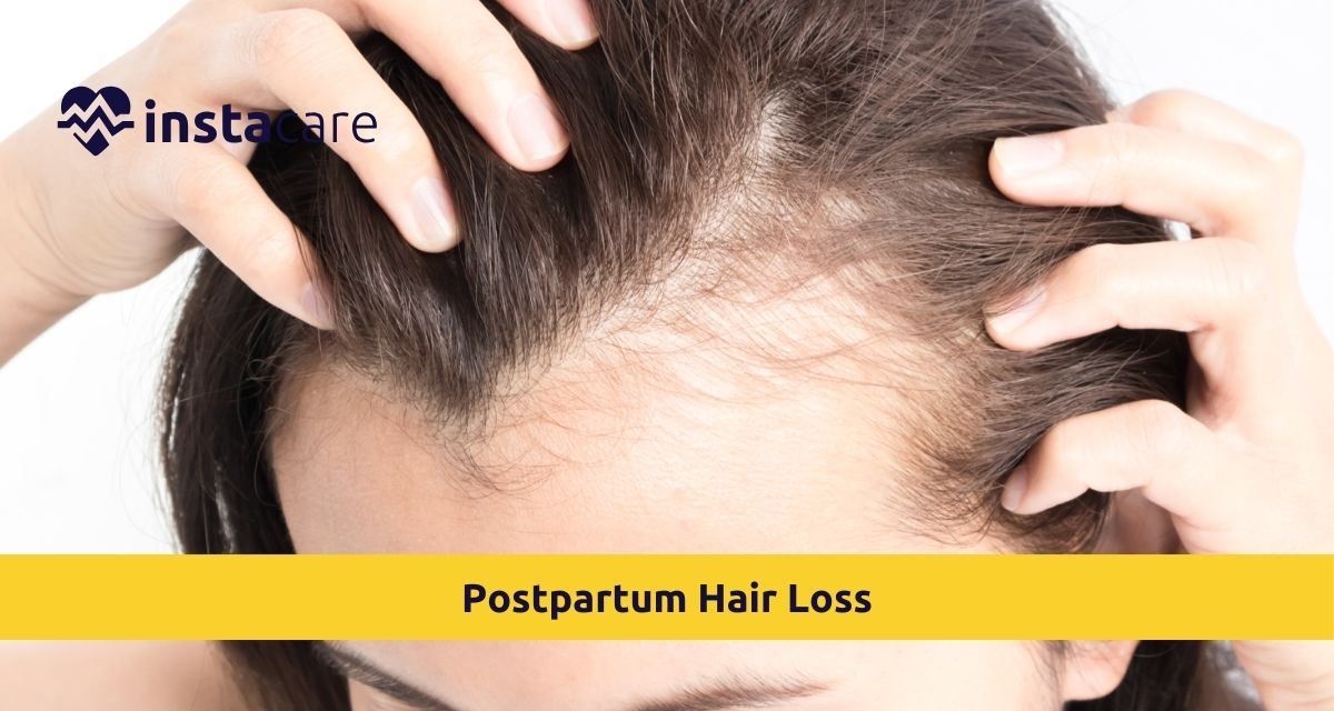 Picture of What You Need to Know About Postpartum Hair Loss