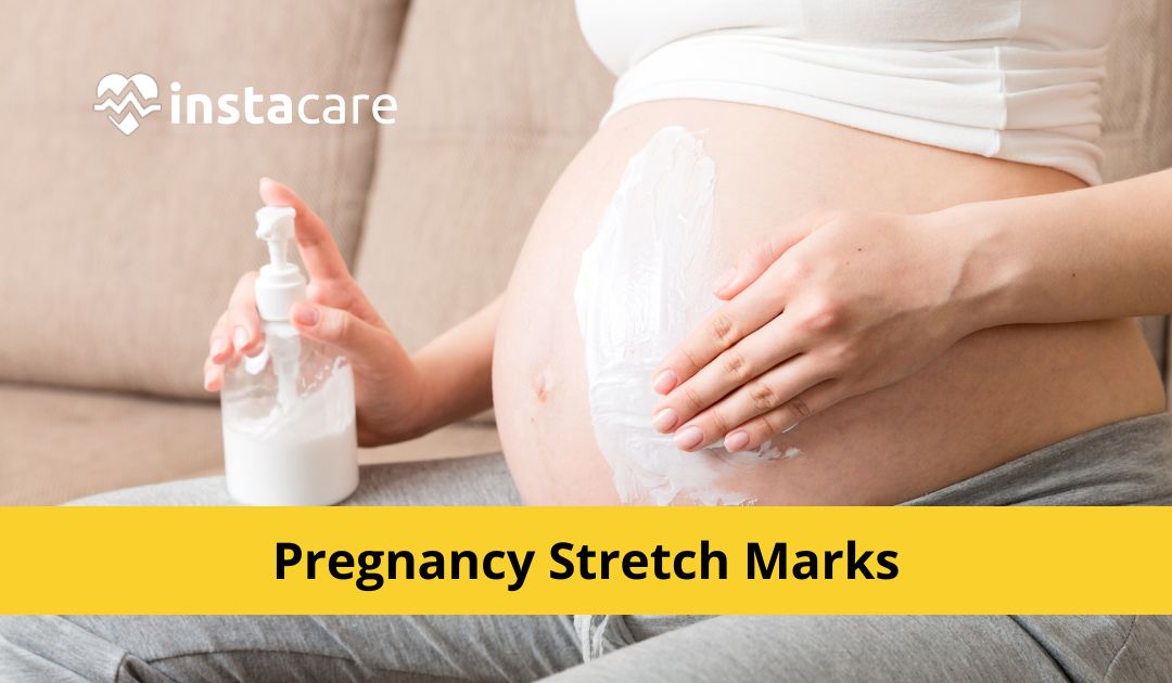 Picture of Pregnancy Stretch Marks Causes Prevention Treatment