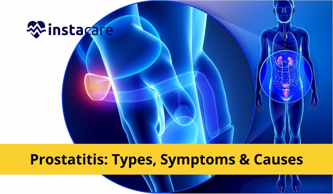 Picture of Prostatitis - Types Symptoms Causes And Treatment
