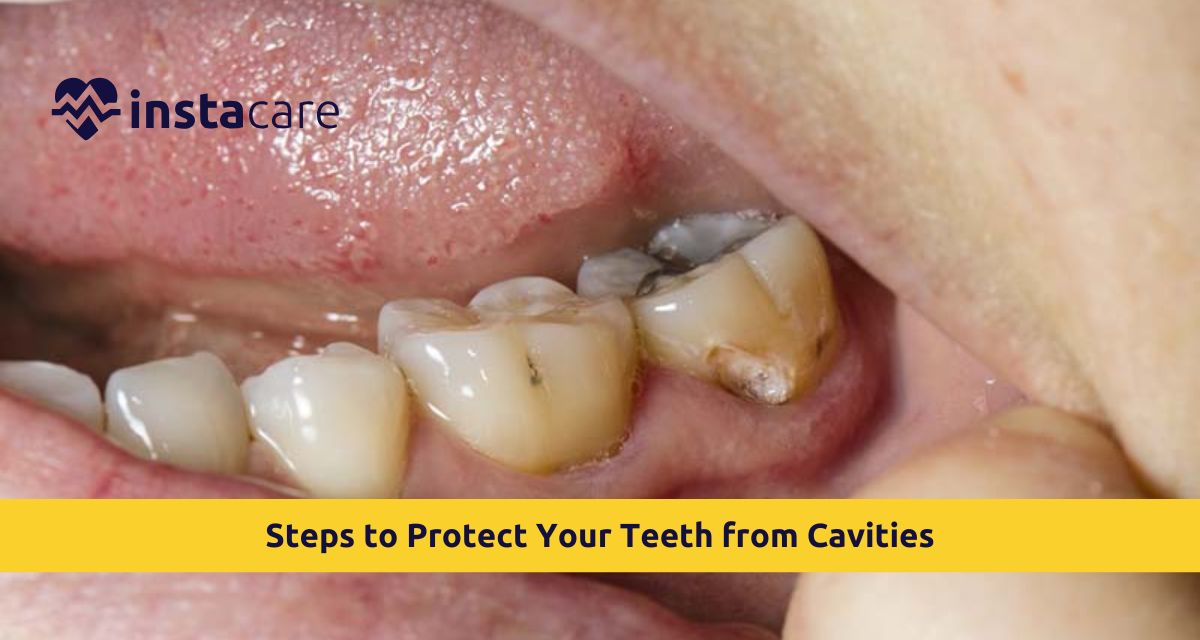 Picture of 7 Steps to Protect Your Teeth from Cavities