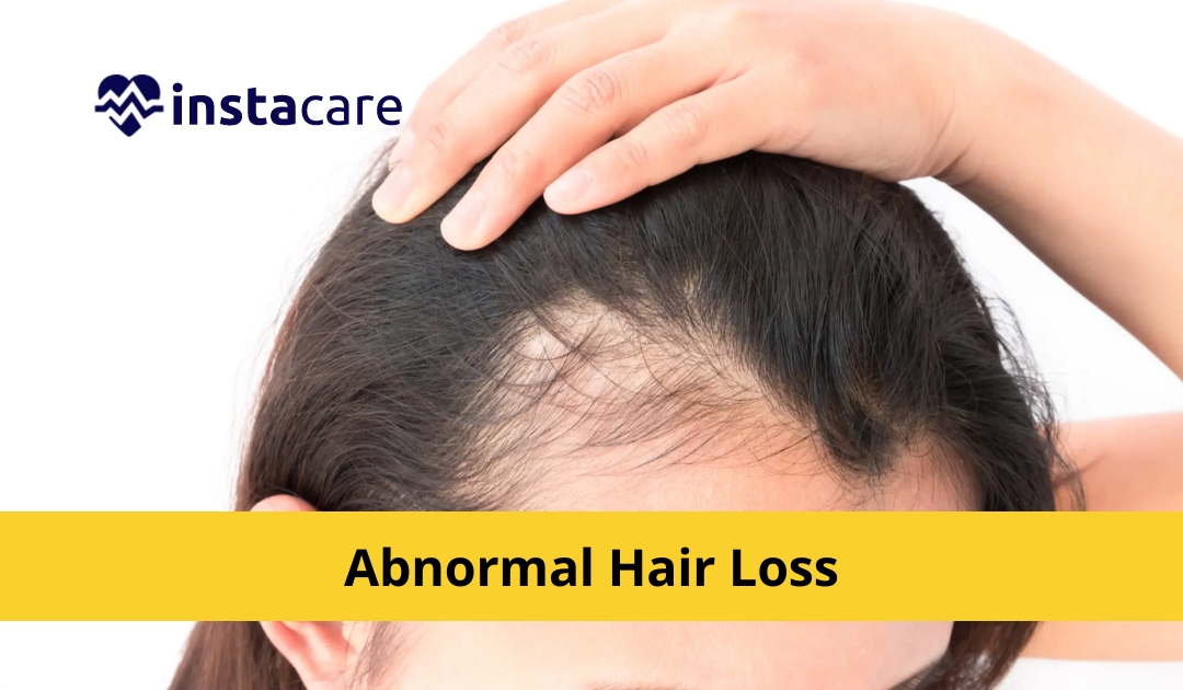 9 Reasons Why You Are Facing Abnormal Hair Loss