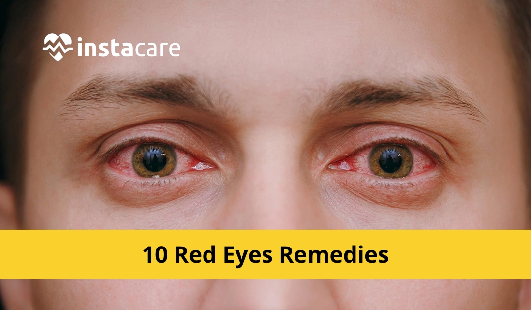 Picture of 10 Effective Red Eyes Remedies