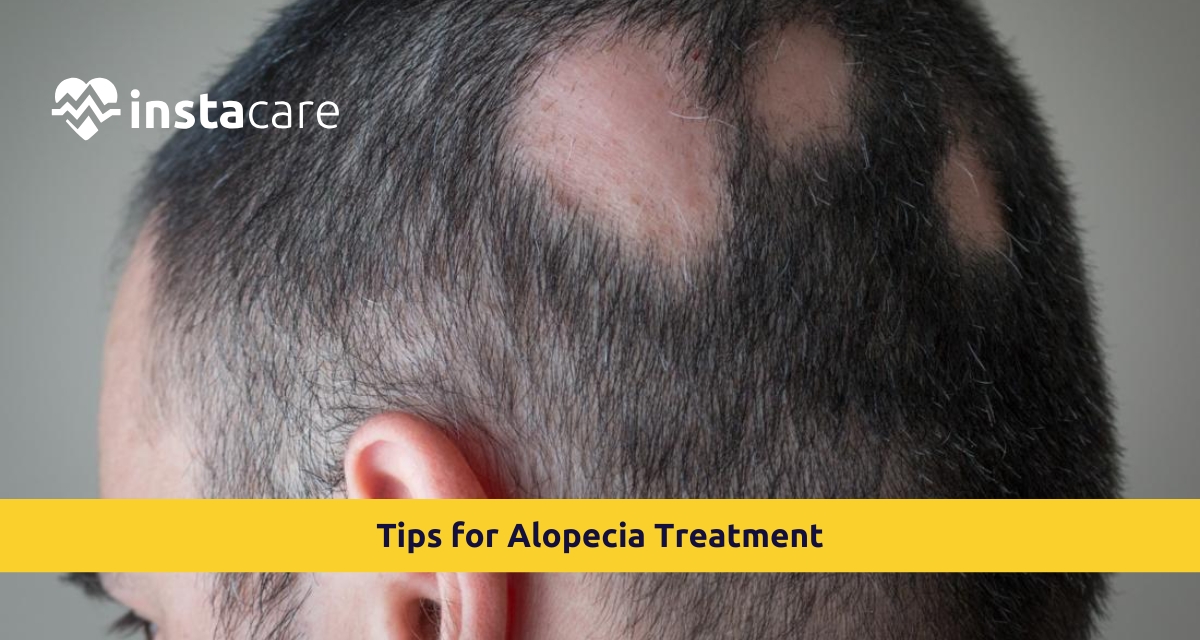 Picture of Regrow Your Hair Naturally Tips for Alopecia Treatment