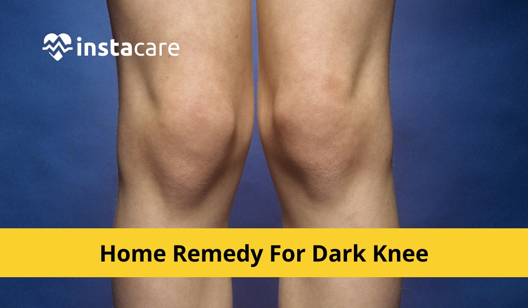 Picture of 10 Home Remedies To Get Rid Of Dark Knees And Elbows