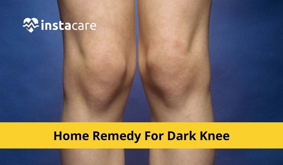 10 Home Remedies To Get Rid Of Dark Knees And Elbows