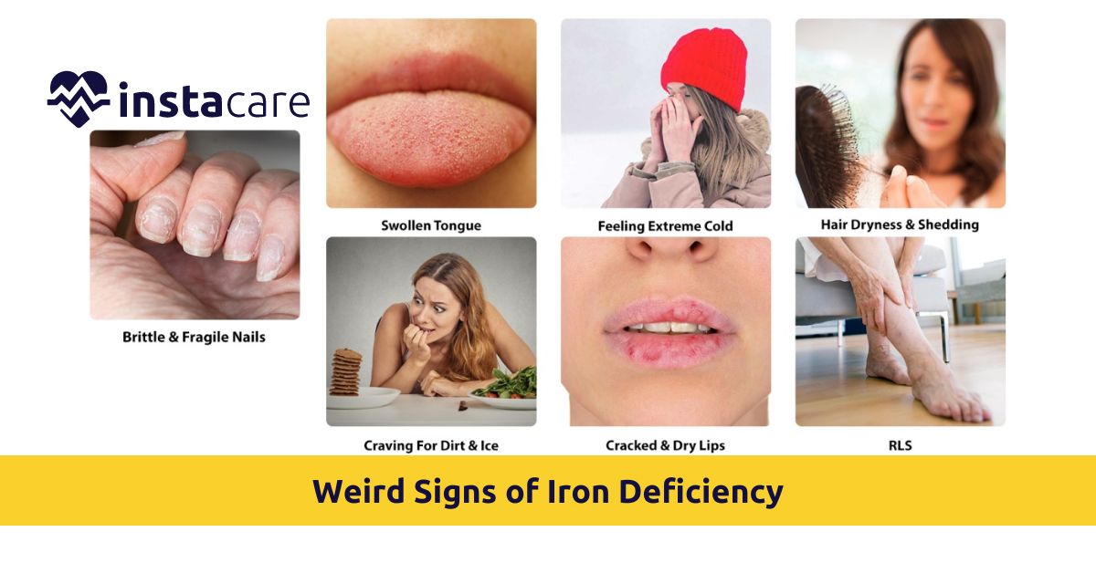 Picture of What Are Some Weird Signs of Iron Deficiency