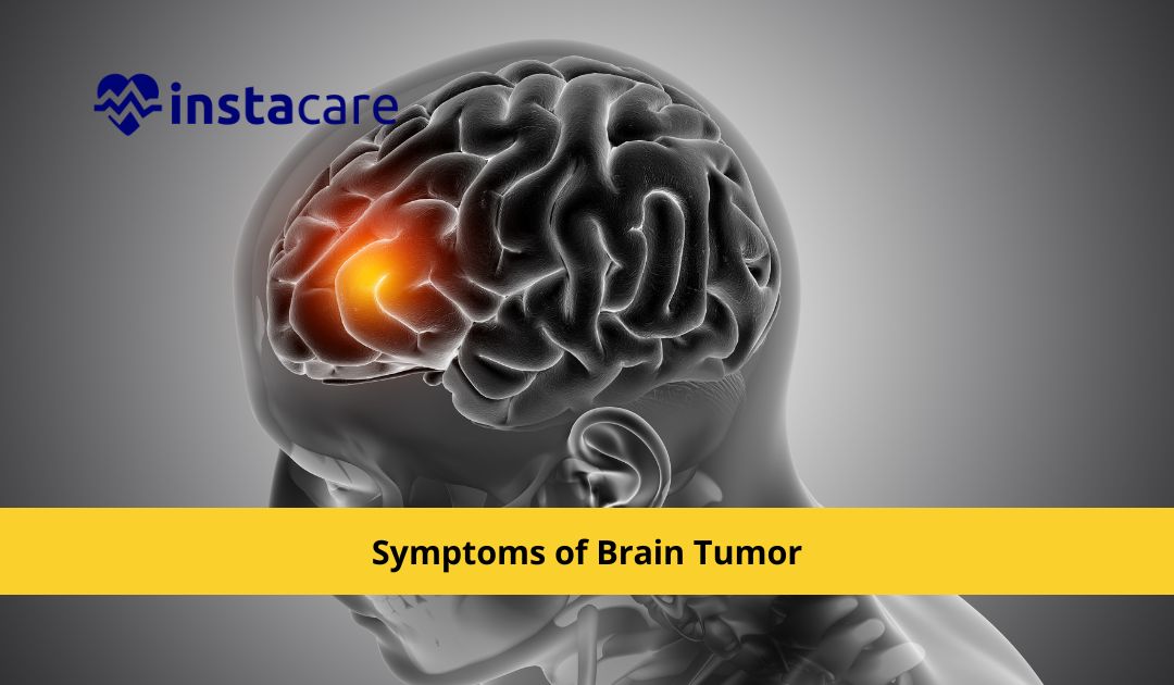 Picture of 8 Silent Symptoms of Brain Tumor that You Need to Know