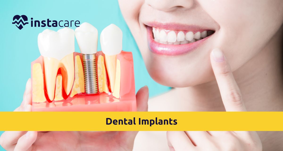 Picture of How Can You Restore Your Smile With Dental Implants