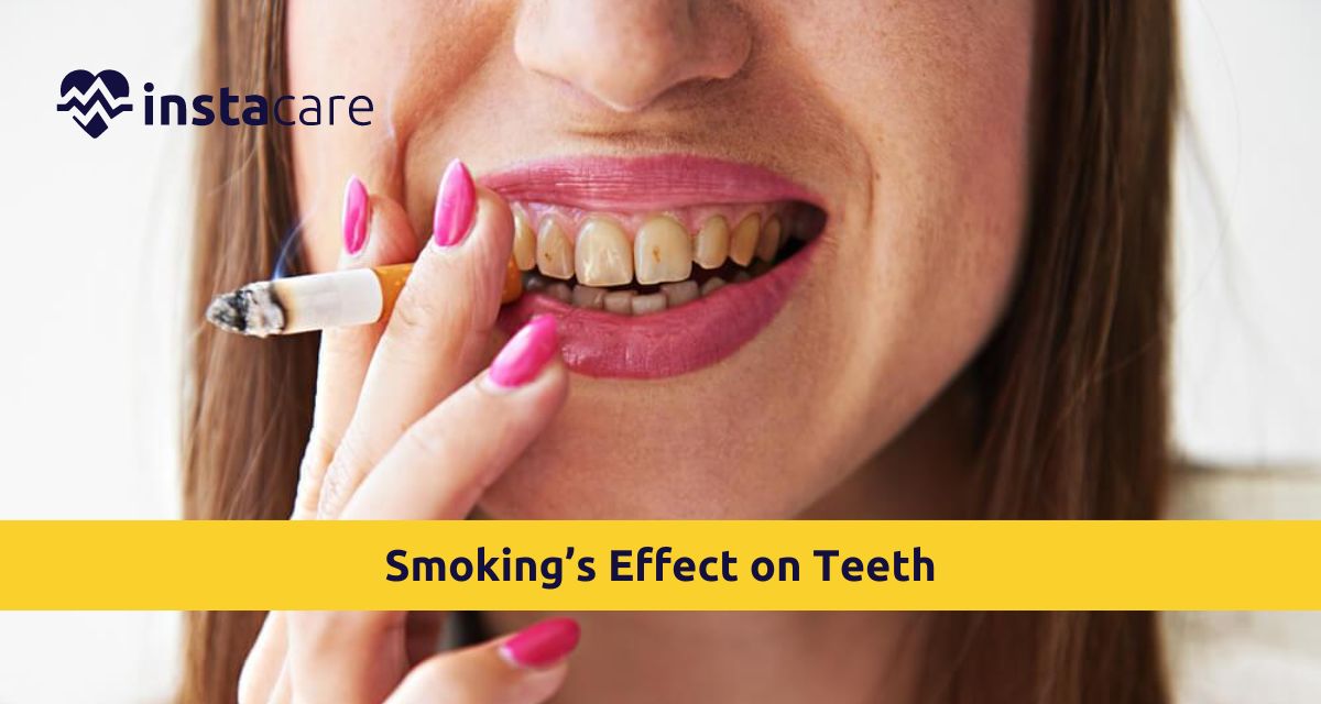 Picture of Smokings Effect on Teeth How Does It Impact Oral Health