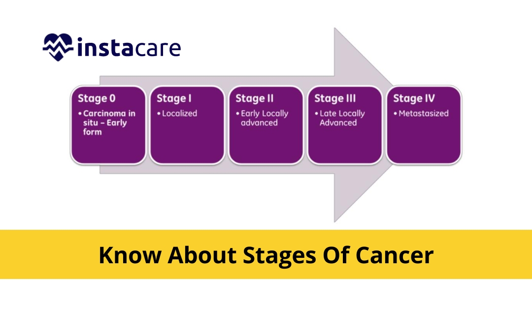 Picture of What Are The Stages Of Cancer