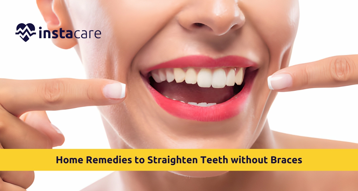 Picture of Home Remedies to Straighten Teeth without Braces