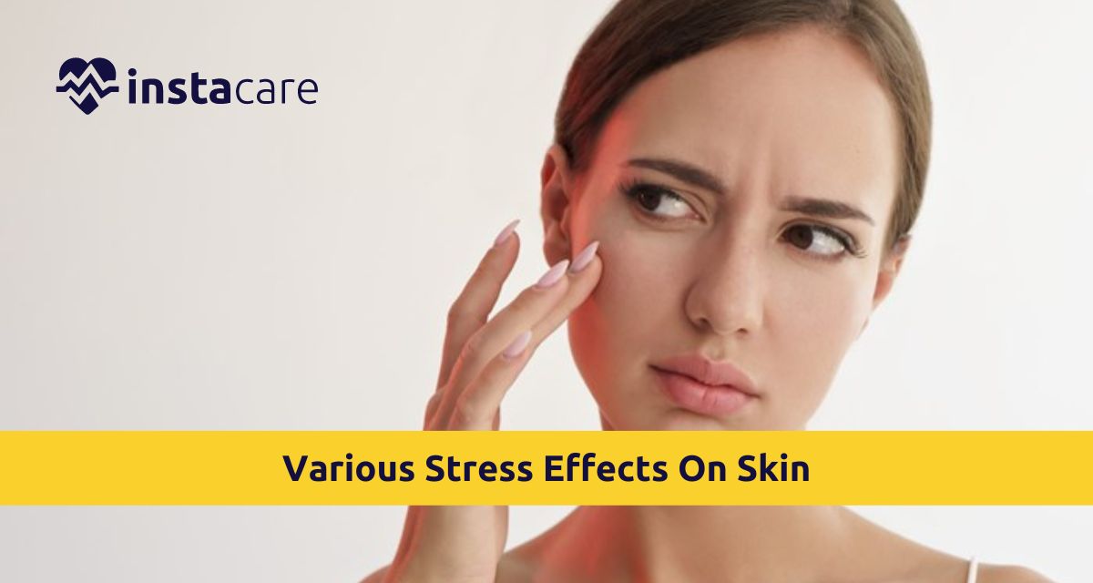Picture of What Are Various Stress Effects On Skin You Need To Know
