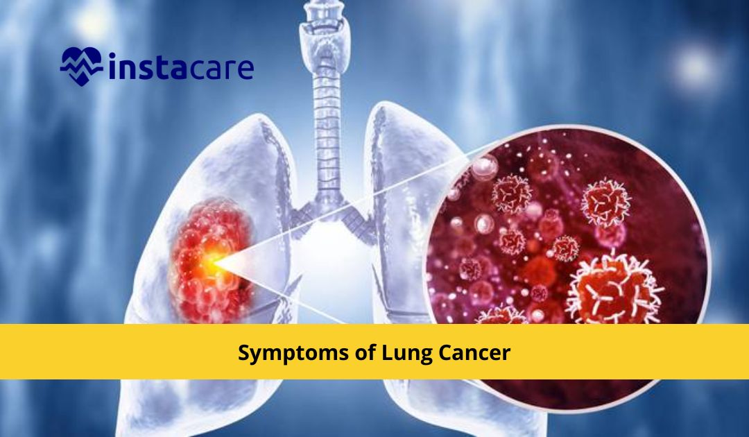 Picture of 5 Symptoms of Lung Cancer That You Should Be Aware of 