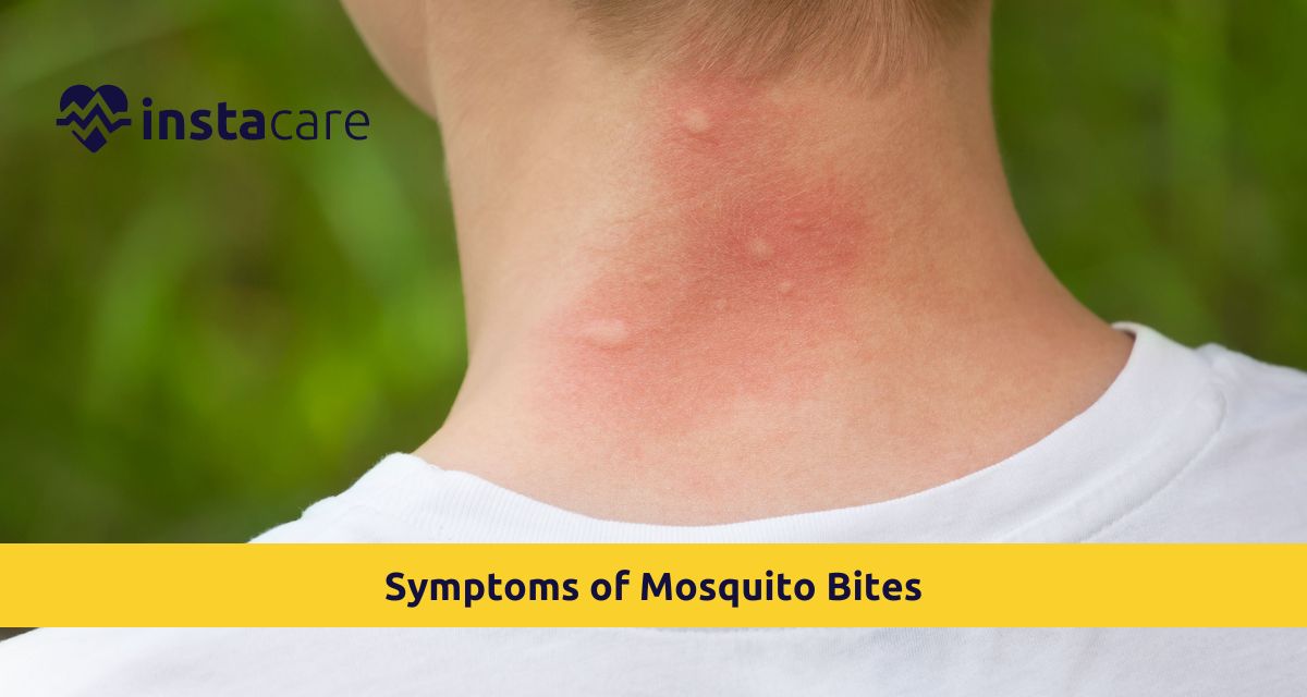 Picture of Symptoms of Mosquito Bites and How to Get Relief