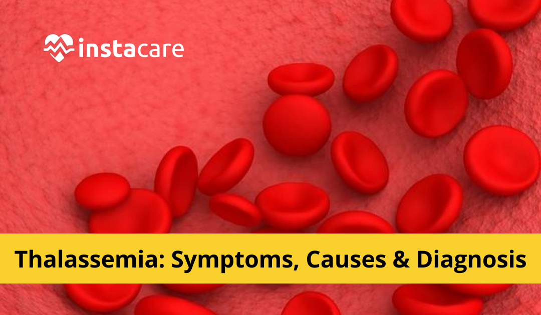 Picture of Thalassemia - Symptoms Causes Diagnosis And Treatment