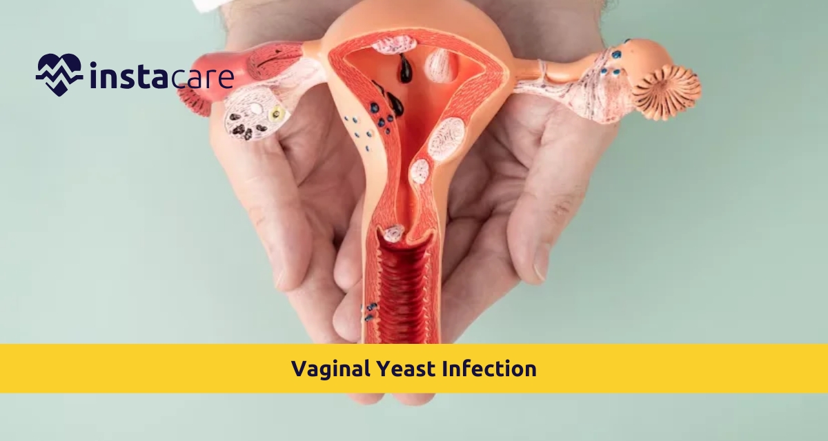 Picture of Vaginal Yeast Infection