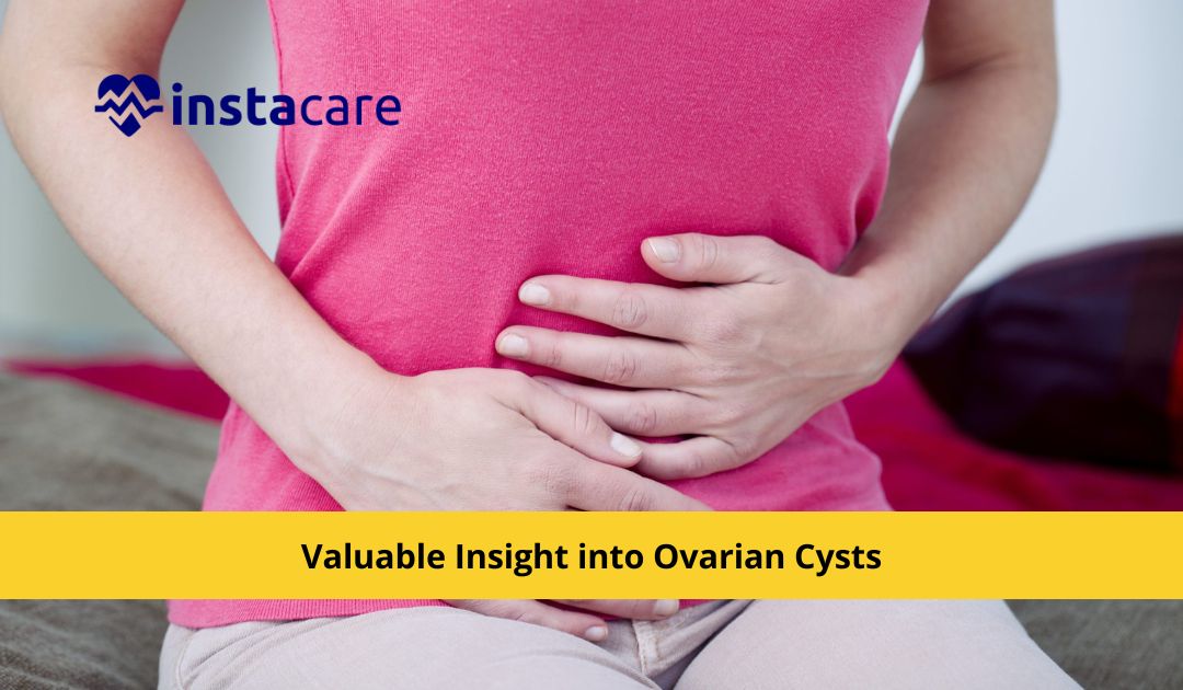 Picture of Valuable Insight into Ovarian Cysts