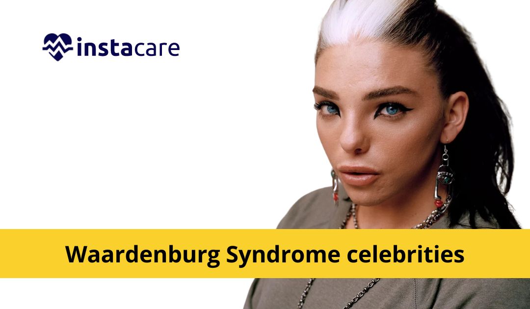 Picture of Waardenburg Syndrome - Causes Symptoms And Treatments 