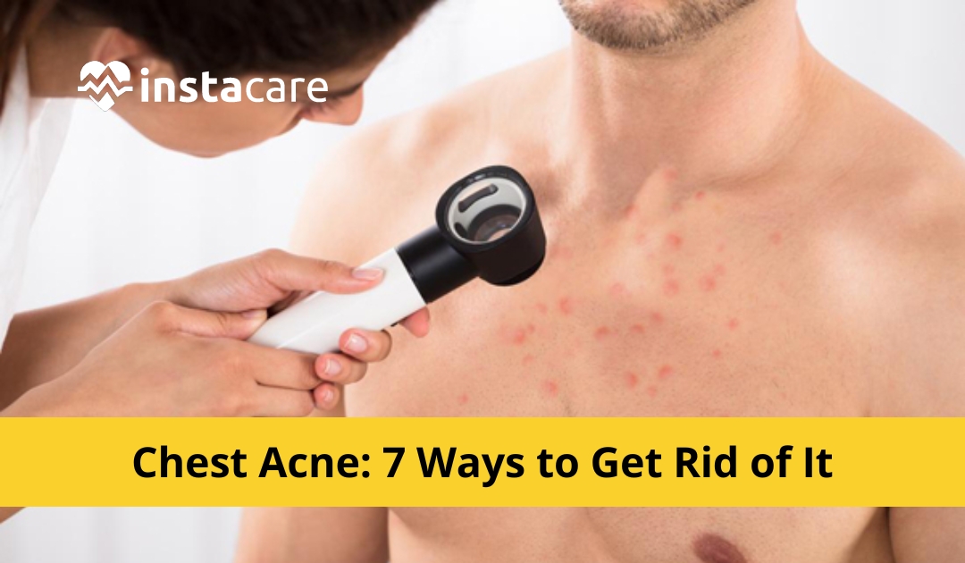 Picture of Chest Acne 7 Ways to Get Rid of It