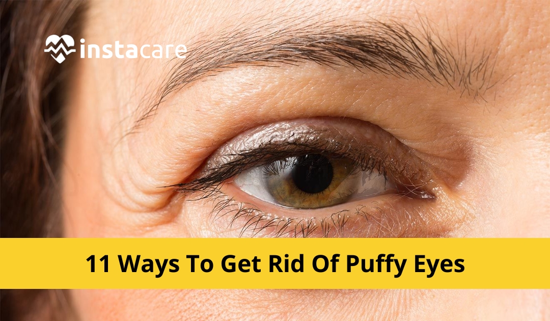 Picture of 11 Ways To Get Rid Of Puffy Eyes