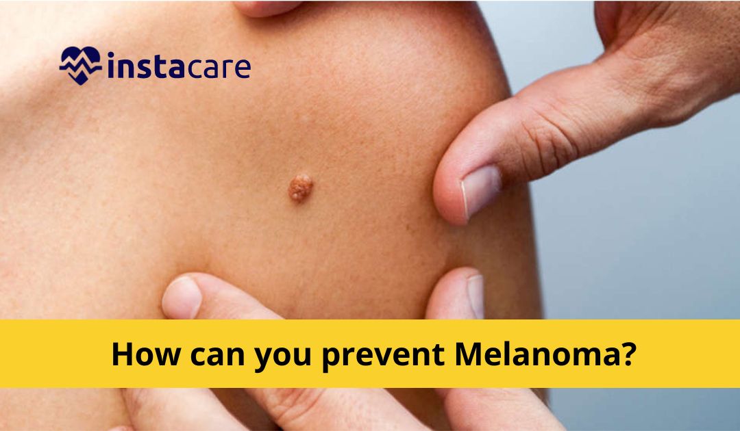 Picture of The Top 9 Ways To Prevent Melanoma