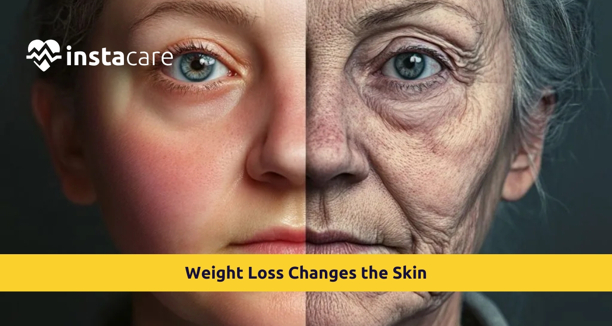 Picture of How Weight Loss Changes the Skin and the Treatments That Can Help