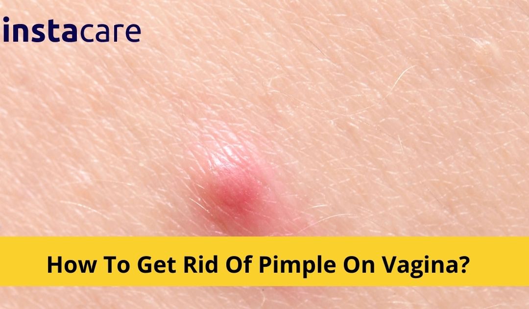 What Are The Causes Of Pimples On Vagina And How to Get Rid Of Them?