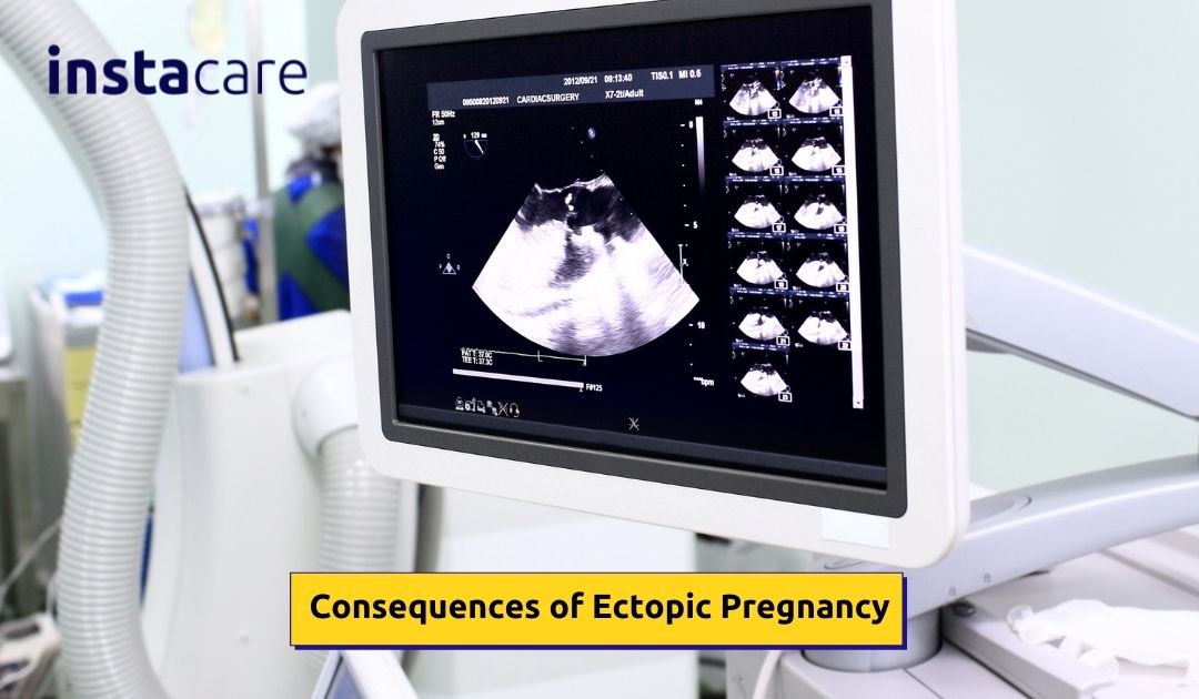 Picture of What Are the Consequences of Ectopic Pregnancy