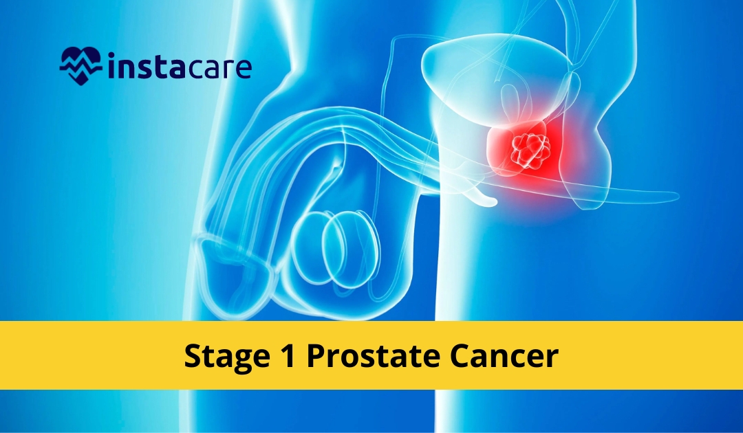 Picture of What Are The Symptoms Causes And Prevention Of Stage 1 Prostate Cancer