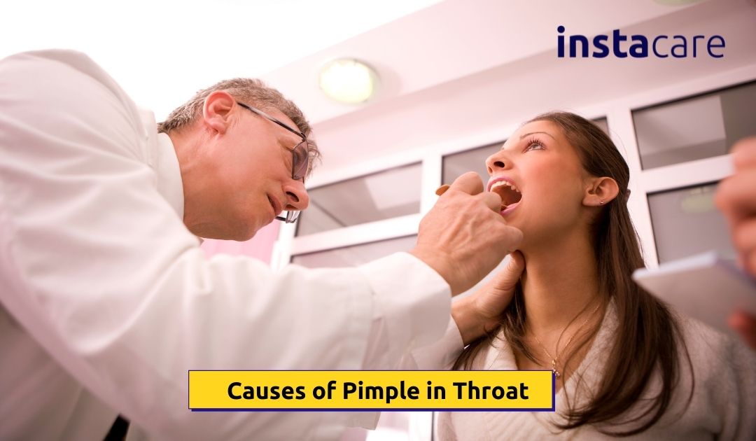 1080px x 630px - What Causes Pimple in Your Throat? - InstaCare