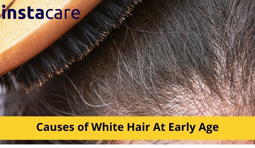 What Causes White Hair At Early Age?