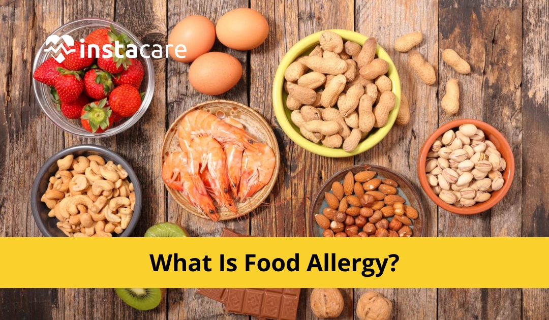 Picture of What Is Food Allergy - Causes Symptoms And Treatment