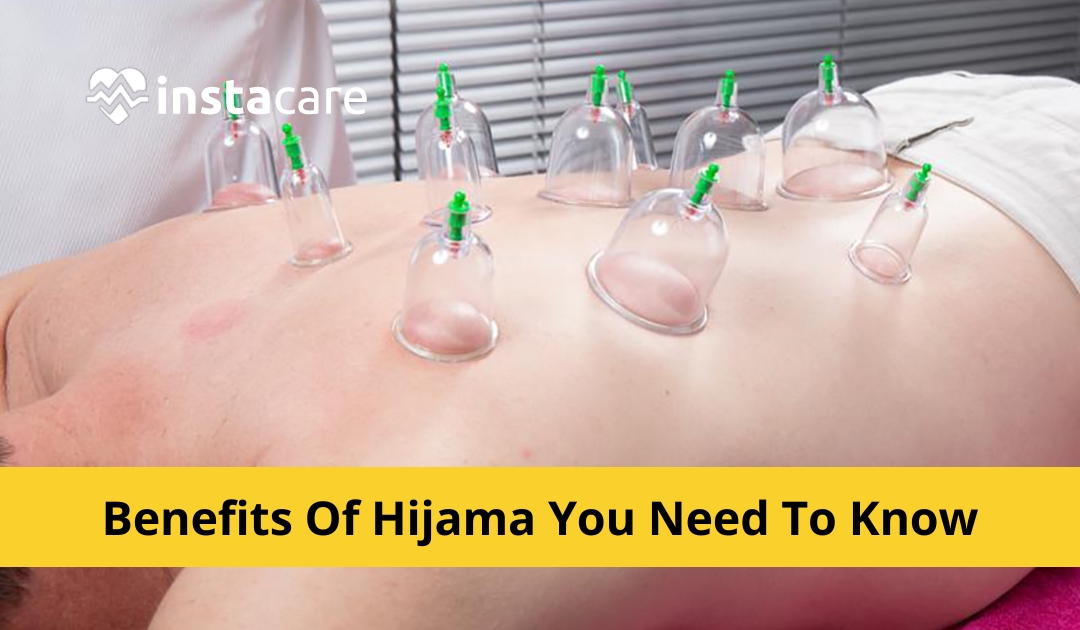 Picture of What Is Hijama Essential Benefits Of Hijama You Need To Know