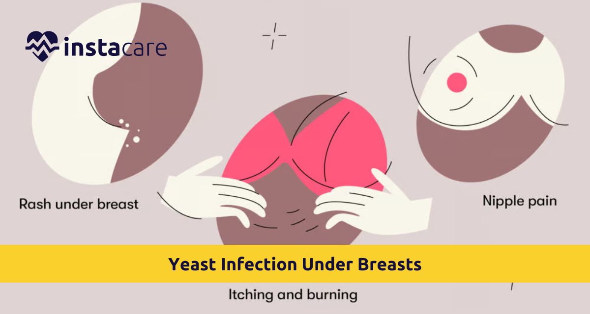 Picture of What You Must Know About Yeast Infection Under Breasts