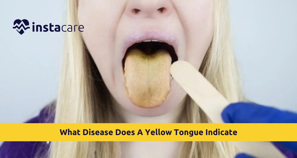 Picture of What Disease Does A Yellow Tongue Indicate